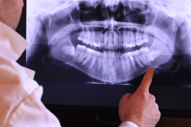 Best Weekend Emergency Dentist in Goliad, TX