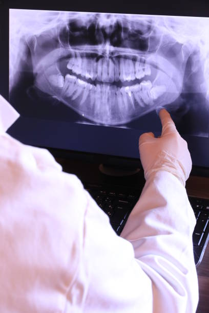 Best Emergency Tooth Extraction in Goliad, TX