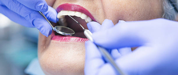 Best Urgent Care for Lost Fillings or Crowns in Goliad, TX
